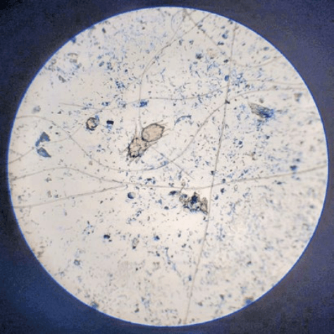 Рис. 3. Микрофото. Клещ Otodectes cynotis Microphoto. Mite Otodectes cynotis