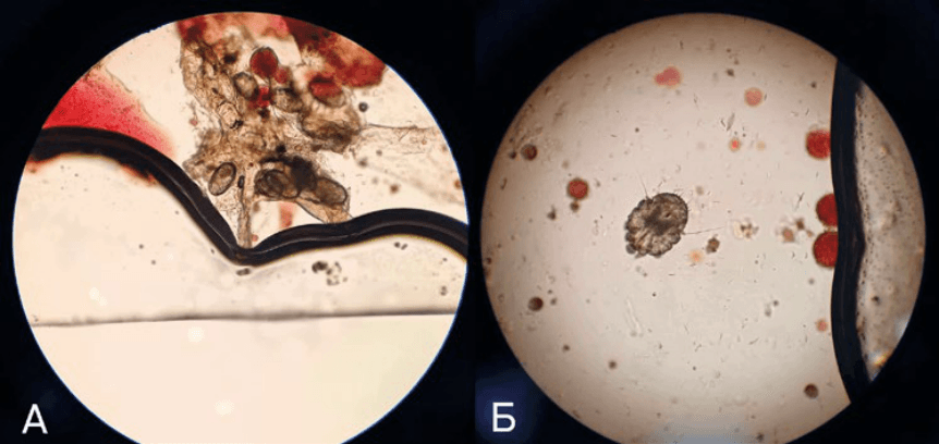Рис. 4. Микрофото. Клещ Sarcoptes scabiei: яйца (A) и имаго (B) клеща Microphoto. Mite Sarcoptes scabiei: eggs (A) and imago (B) of the mite